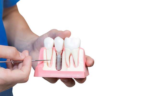 Can You Get Dental Implants If You Have Gum Disease?
