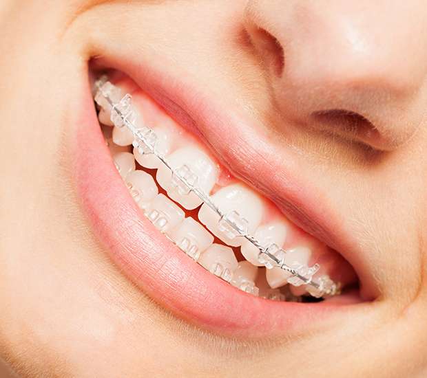 Bellevue Invisible Orthodontics