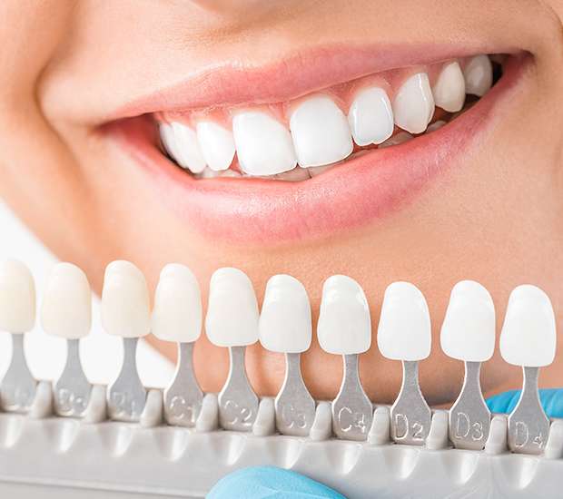 Bellevue Cosmetic Dentist