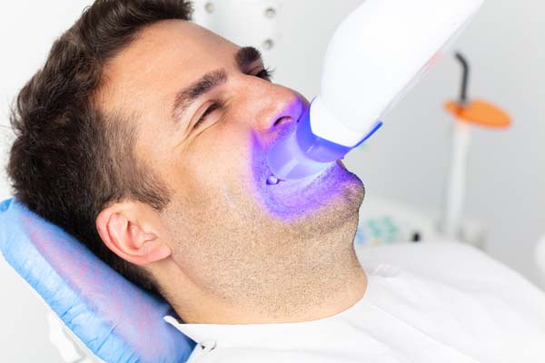 Tips To Prolong The Longevity Of Dental Bonding