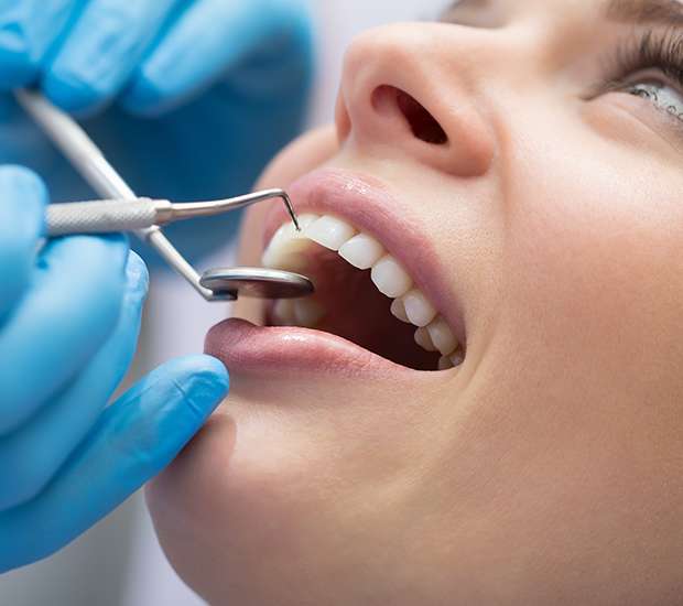 Bellevue Dental Restoration