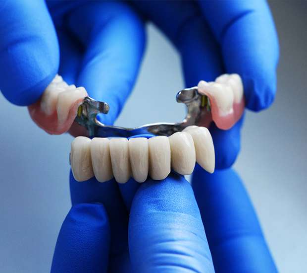 Bellevue Dental Bridges