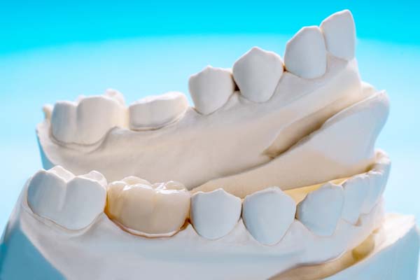 Tips To Help Dental Crowns Last Longer