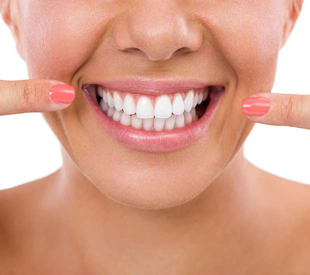 Bellevue What Is Gum Contouring and Reshaping