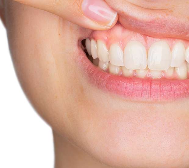 Bellevue Gum Disease