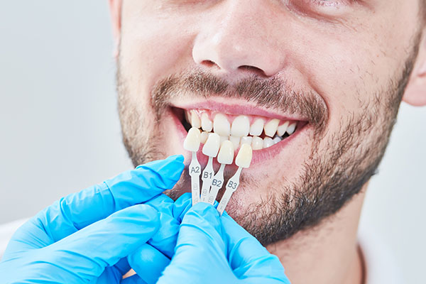 How Are Veneers Replaced? from Artisan Dental in Bellevue, WA