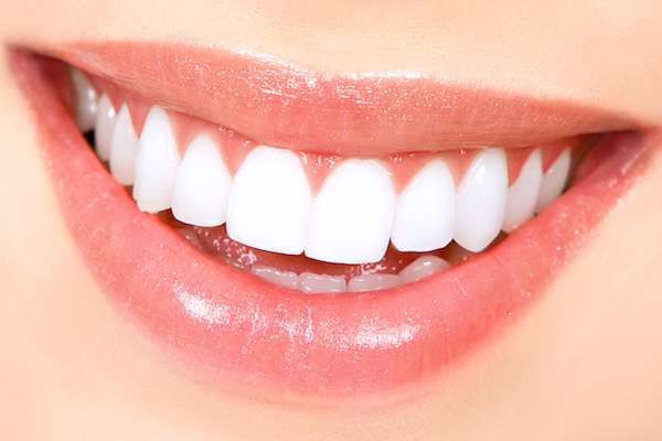 How Long Does Teeth Whitening Take from Artisan Dental in Bellevue, WA