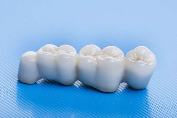 How Many Teeth Can Dental Bridges Replace from Artisan Dental in Bellevue, WA