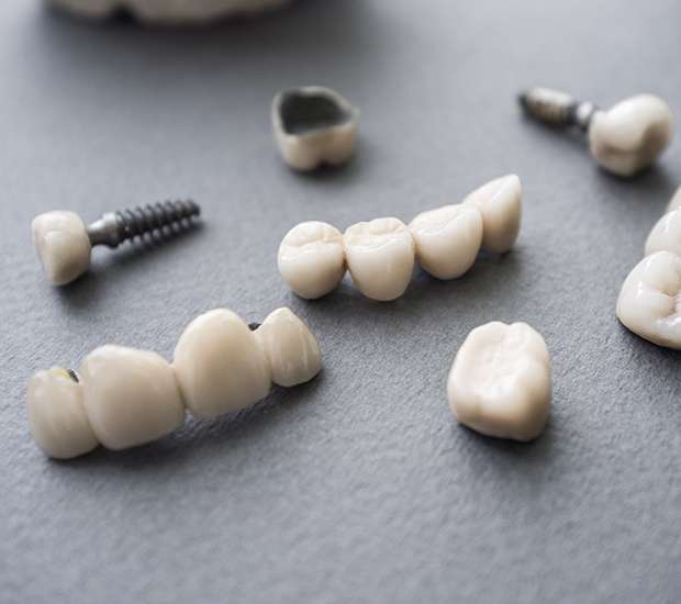 Bellevue The Difference Between Dental Implants and Mini Dental Implants