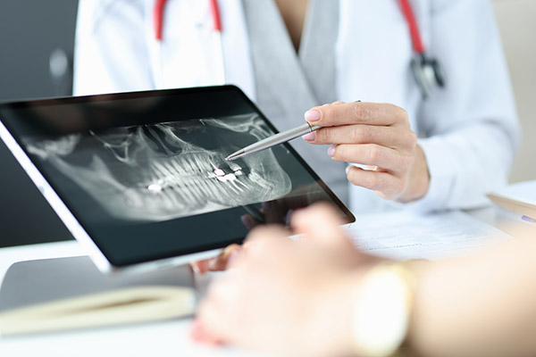 The Importance of Regular Dental Checkup X-Rays from Artisan Dental in Bellevue, WA