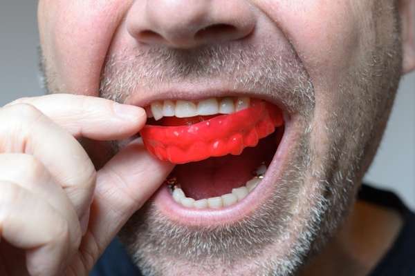 Save Your Teeth by Wearing Mouth Guards at Night from Artisan Dental in Bellevue, WA