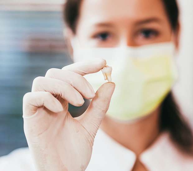 Bellevue Tooth Extraction