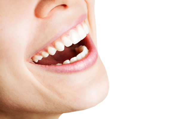 Who Is A Good Candidate For Veneers?