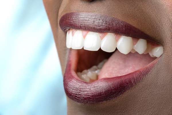 Routine Dental Care: What Are Tooth Colored Fillings from Artisan Dental in Bellevue, WA