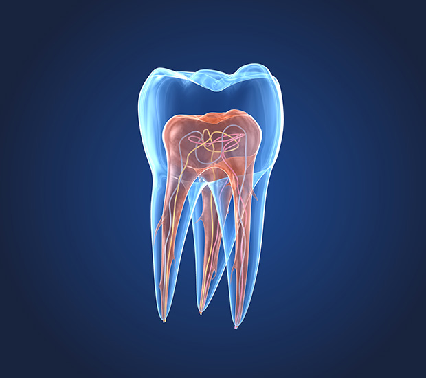 Bellevue What is an Endodontist