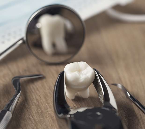 Bellevue When Is a Tooth Extraction Necessary